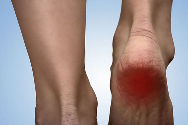 chronic heel pain